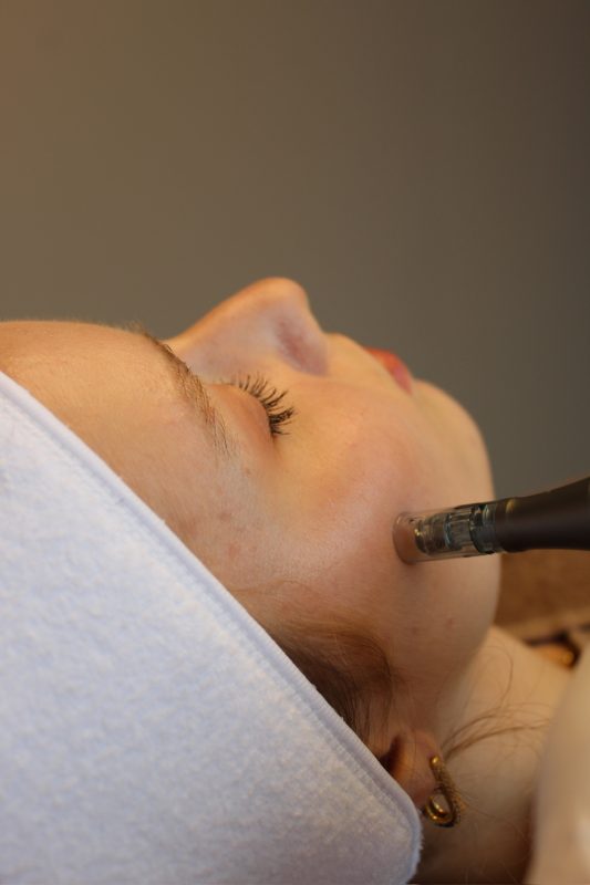 CLC Microneedling