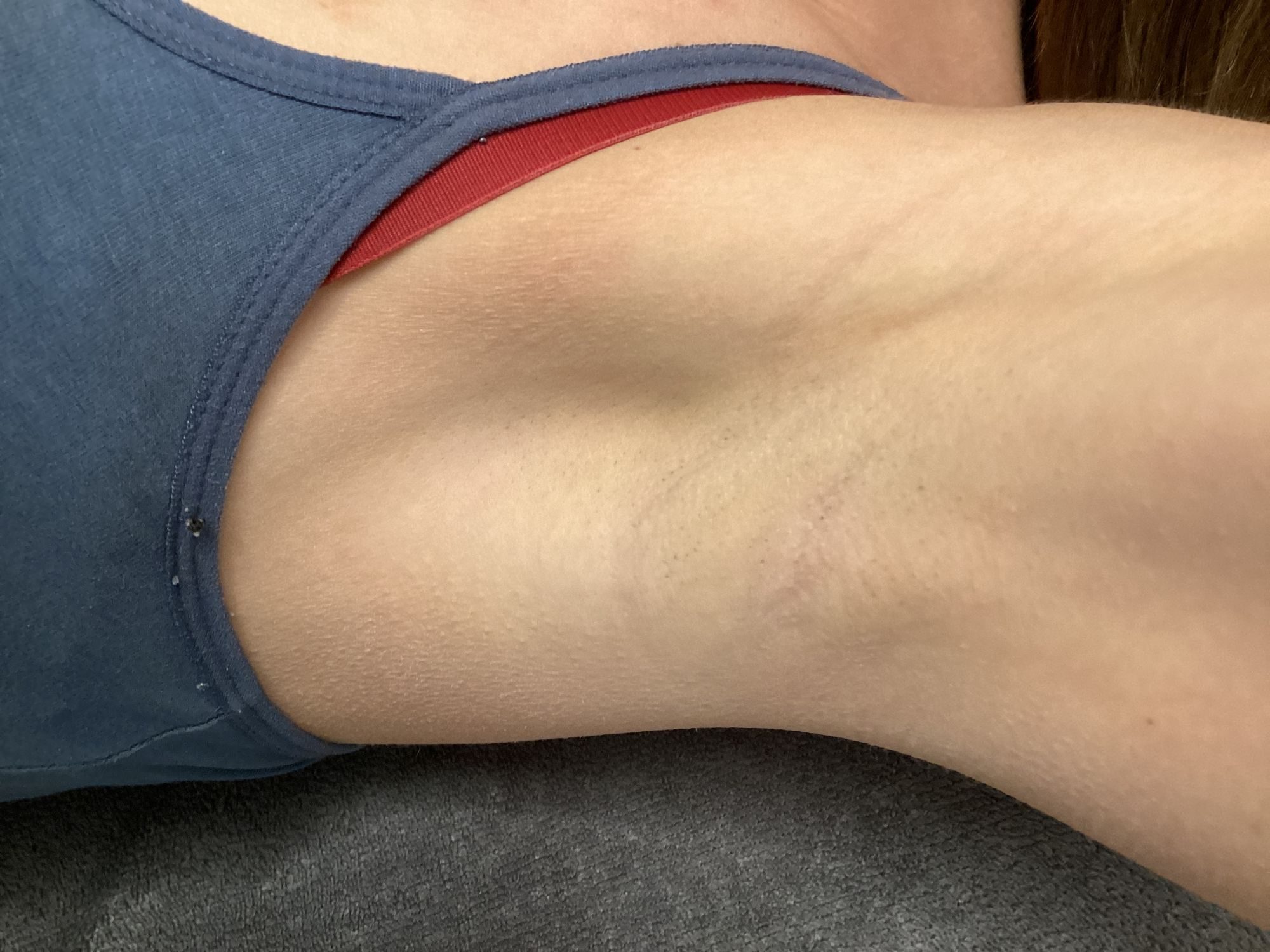 Oksels ontharen after