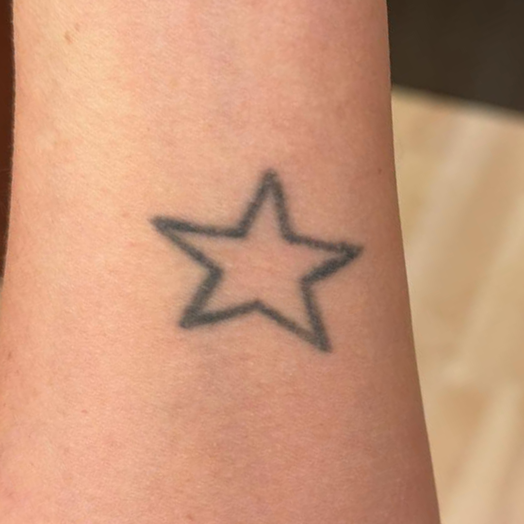 Ster tattoo before